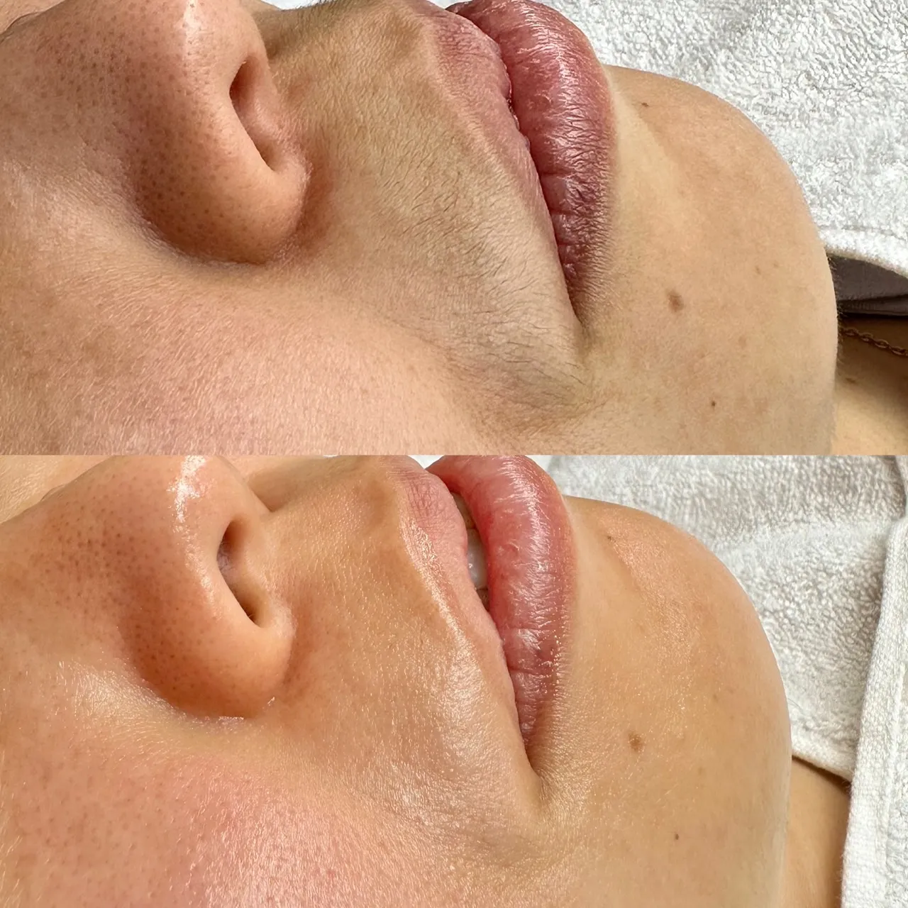 フェイシャルWAX（エイジングケア）