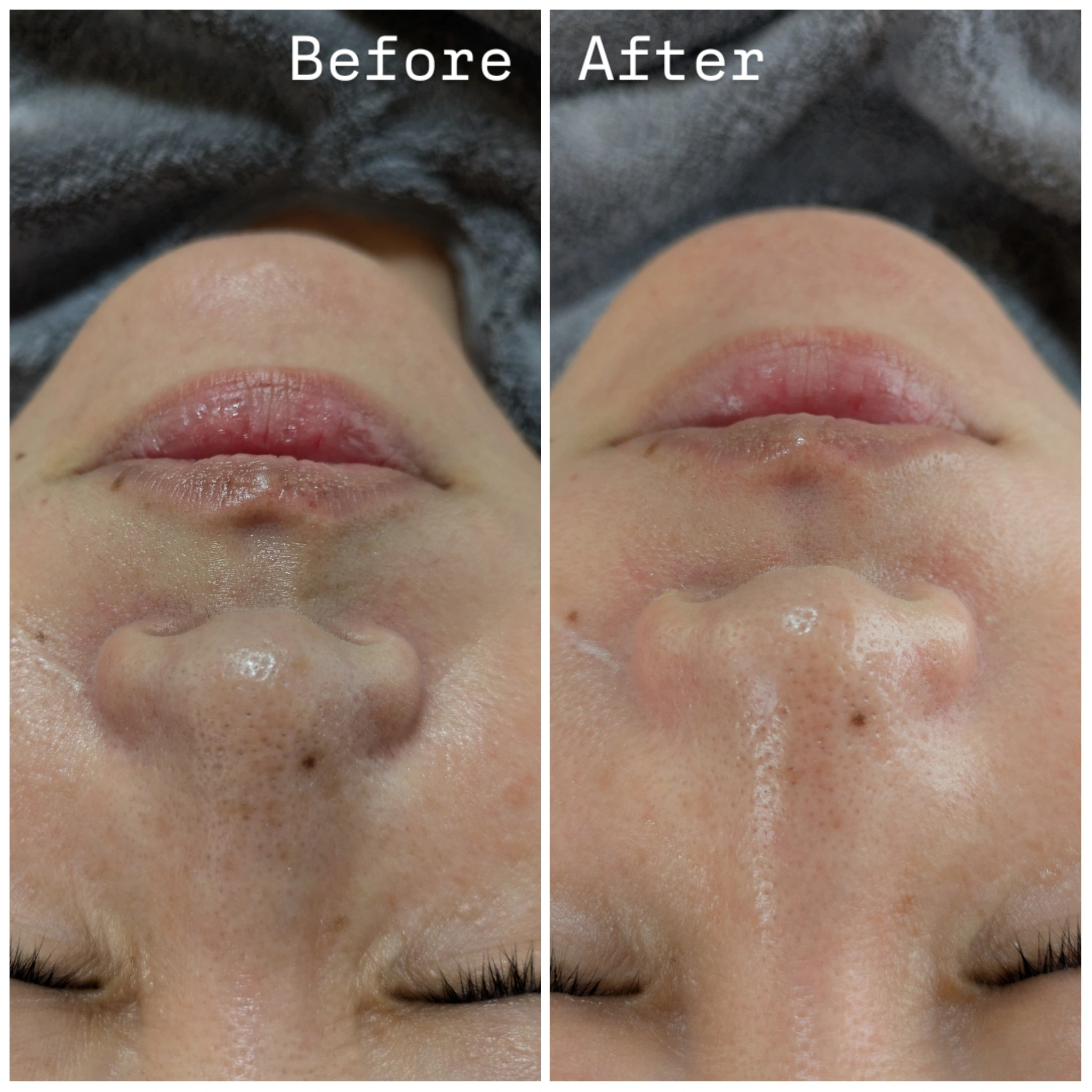 ハンドマッサージ